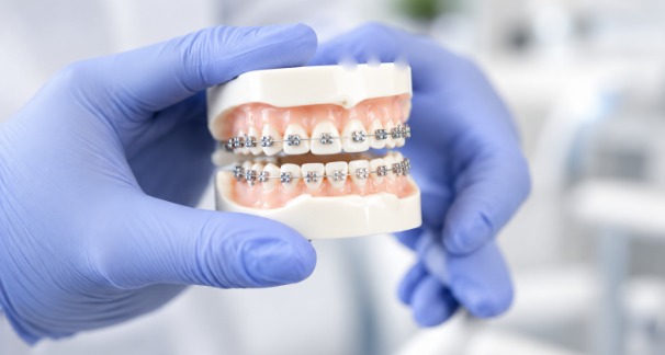 Appareil orthodontique